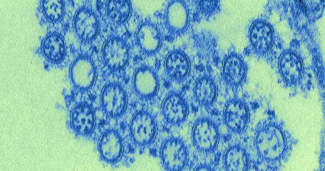 h1n1-pandemic